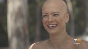 '\'I Want To Normalize Bald Women\': Model, Fitness Instructor, Dancer Christie Valdiserri Shares Journ'