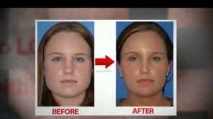 'How to Get Rid of A Double Chin Fast! - Face Fitness Formula Review'