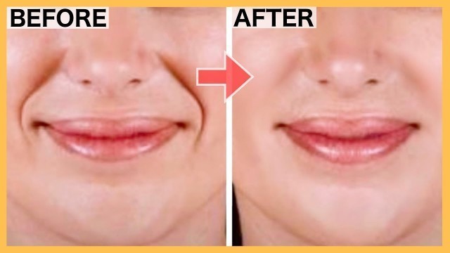 'SMILE LINES Facial Exercises (Nasolabial Folds/ Laugh Lines) | Lift Smile Lines with this WORKOUT!'